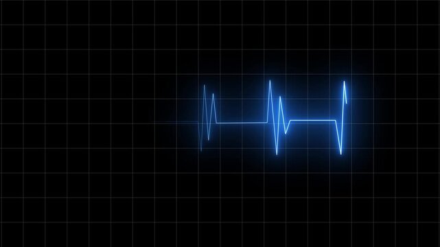 ekg monitor screen