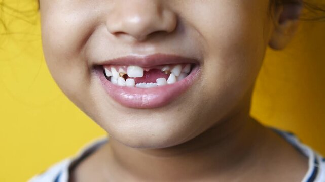 Close up slow motion video of smiling indian child showing gap in teeth, baby teeth falling out for permanent ones to grow in, capturing natural childhood milestone against yellow background