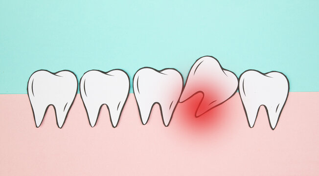 Crooked teeth row, toothache, wisdom tooth issue, lack of space, dental extraction, inflammation or acute pain