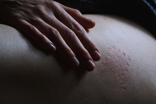 Close-up of hand and patterned skin imprint on bare hip
