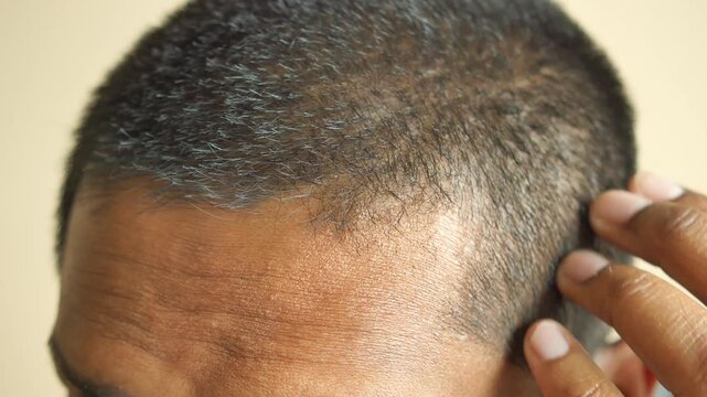 A close up view of a man touching his short black hair, showing a few grey strands on his head, natural aging process with a hand checking his hairline