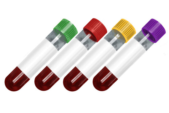  Four blood collection tubes with green, red, purple EDTA, and light blue sodium citrate caps isolated on transparent background. Medical laboratory vacuum blood test tubes for healthcare, clinical di