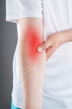 Close up of man holding painful arm with red highlighted inflamed vein, concept of phlebitis or thrombosis