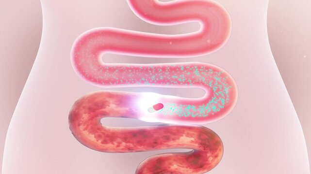Gut Repair 3D Medical Animation: Medicine Capsule Healing Damaged Intestinal Tract
