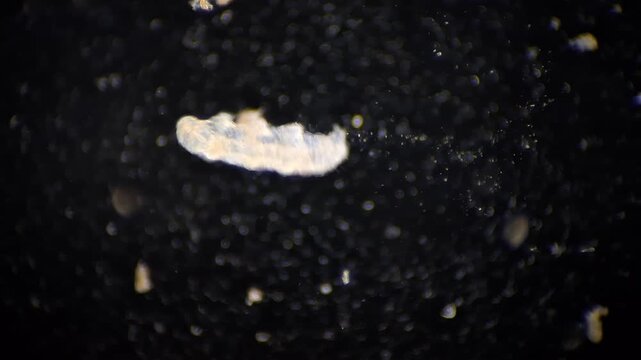 Microscope footage of a tardigrade water bear moving in darkfield illumination 