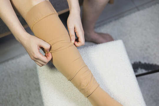 Woman pulling up and adjusting a beige medical compression stocking on her leg.