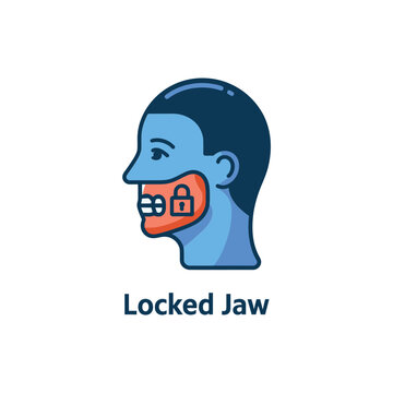 Locked jaw medical condition representing trismus and muscle spasm symptoms for healthcare awareness and patient education visual