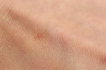 Fototapeta premium Texture of normal skin as background, closeup