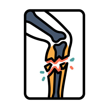 Compound Fracture Leg Bone X-Ray Icon for Surgery