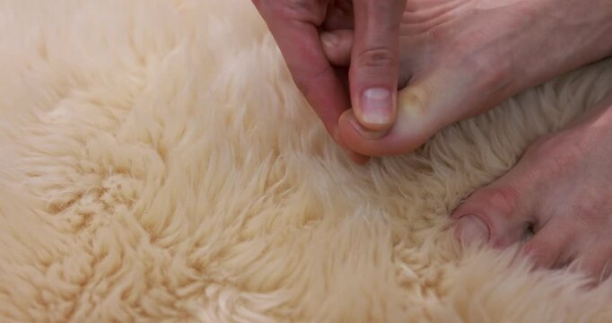 Woman with callus plastering her foot on fluffy rug, closeup