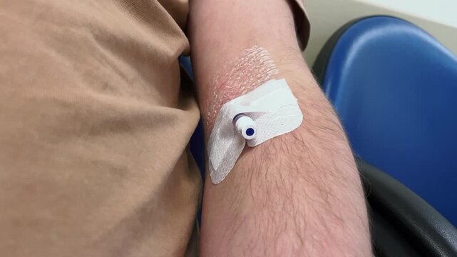 Close up handheld front view of intravenous cannula in man's arm