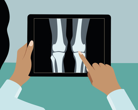 Medical professional reviews x-ray of knees on tablet in clinic setting