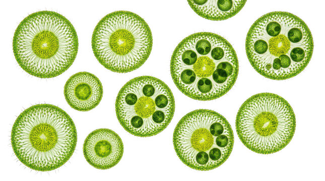 Collection of microscopic green diatoms, circular silica shells, detailed structure, viewed under microscope on transparent background.