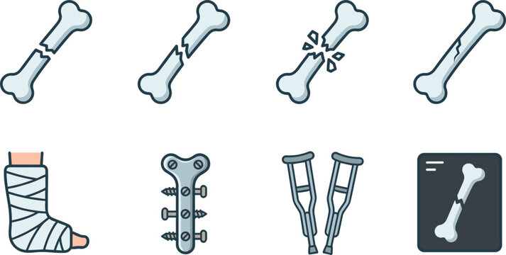 Bone Fracture and Orthopedics Vector Icon Set with Broken Bones Cast Bandage Surgical Plate Screws Crutches and Xray Medical Healthcare Designs