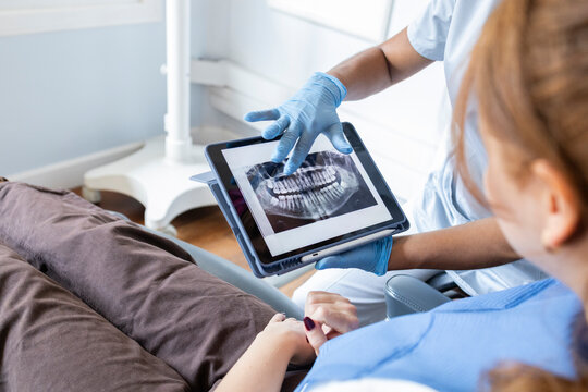 Dentist explaining X-ray results to a patient