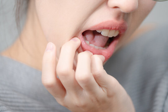 Oral health concept. Young woman touching her sore mouth while wearing glasses at home, representing gum inflammation, mouth ulcer and dental pain. Oral health, gums, ulcer, dental, pain.