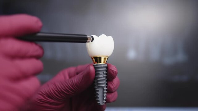 Dentist explains dental implantation by demonstrating the artificial root, abutment, and crown beside a dental X-ray image.