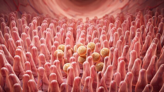 Medical Illustration of Cyclospora Parasite Infection in Human Small Intestine Villi