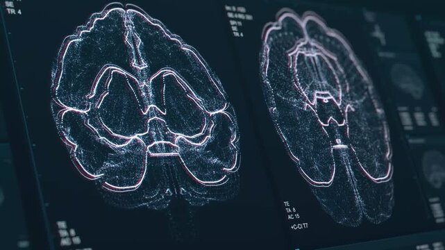 Advanced medical 3d animation 3d video Health healthcare analysis showing Kidney pain bowel pain and 3D scan of internal organs brain 123