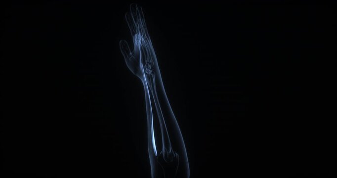 Flexor carpi radialis muscle in human body. X Ray. Loop