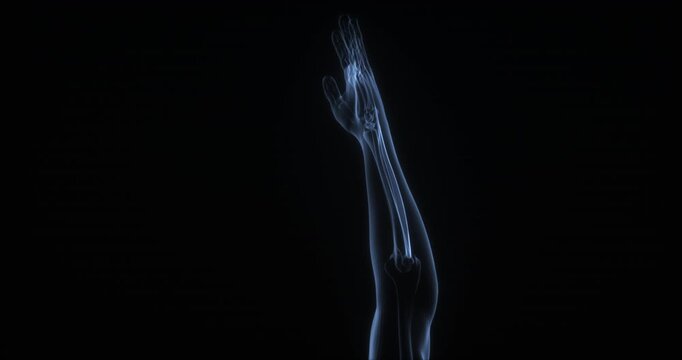 Extensor carpi ulnaris muscle in human body. X Ray. Loop