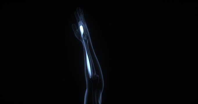 Palmaris longus muscle in human body. X Ray. Loop
