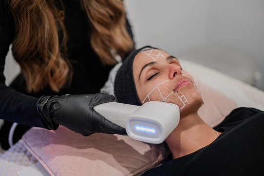 Client undergoes laser facial treatment by therapist in a skin and body clinic