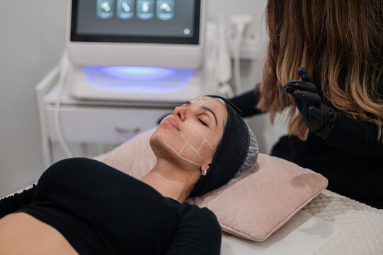 Female client with facial map lying comfortably on treatment bed in a skin and body clinic