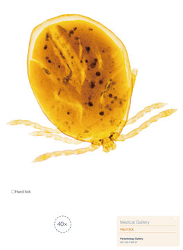 Hard ticks are parasites that attach to a host; their bites are painless, and they can transmit bacterial, protozoal, and viral diseases such as Lyme disease, encephalitis, and tularemia.Magnify 40x
