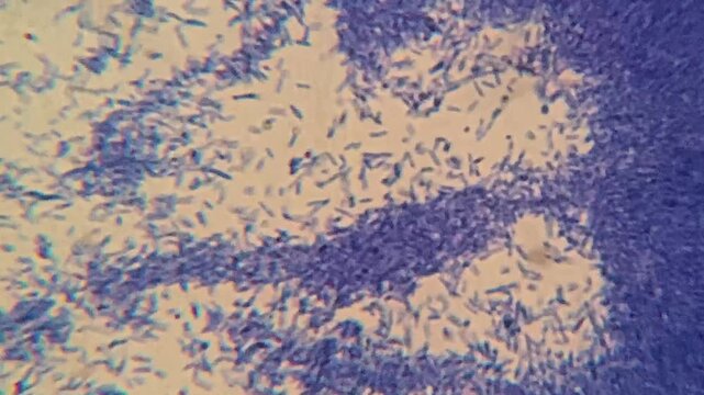 Crystal violet stained bacteria colony viewed under light microscope magnification
