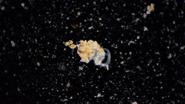 ​Microscopic view of a fast-moving nematode under darkfield microscopy 