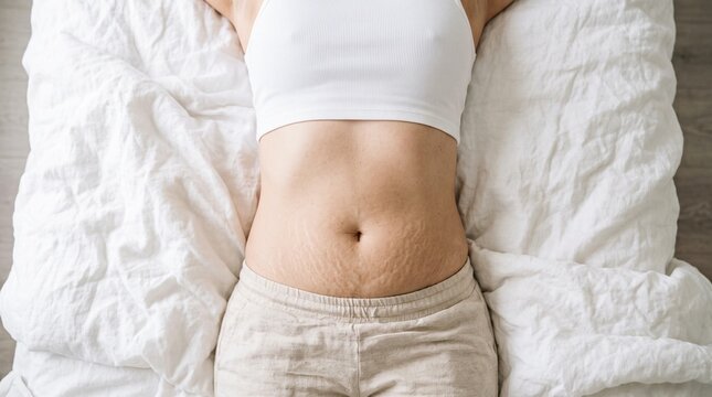 Woman showing stretch marks on belly while lying on white bed. Body positivity and self acceptance concept.
