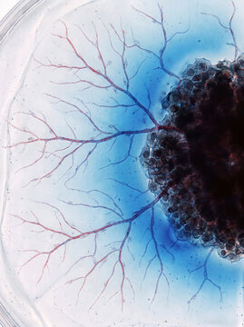 Tumor Angiogenesis with Early Blood Vessel Growth Toward Malignant Cancer Cells