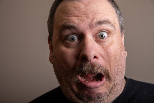 Man with short hair and dark shirt looks surprised