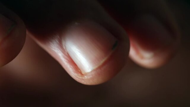 Macro view of a finger with a bruise under the nail
