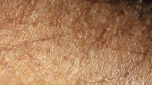 Macro view of human skin with long hairs on it, anatomy