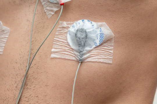 Man with equipment for Holter monitoring or electrocardiogram (ECG) examination. Cardiac medical examination.