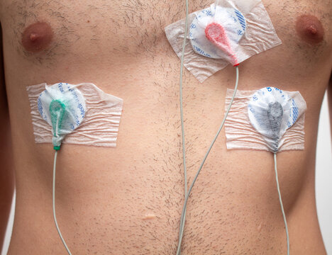 Man with equipment for Holter monitoring or electrocardiogram (ECG) examination. Cardiac medical examination.