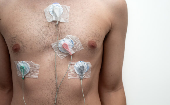 Man with equipment for Holter monitoring or electrocardiogram (ECG) examination. Cardiac medical examination.