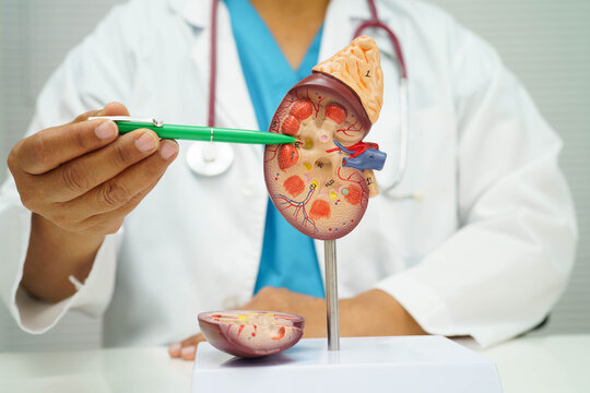 Chronic kidney disease, doctor with model for treatment urinary system, urology, Estimated glomerular filtration rate eGFR.
