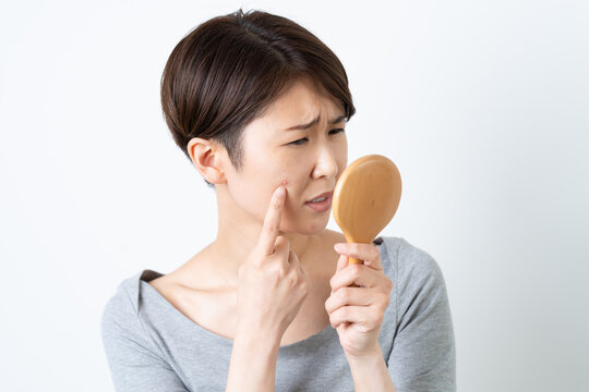 顔のにきびに悩む女性