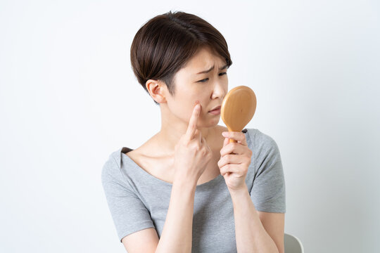 顔のにきびに悩む女性