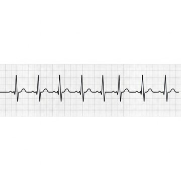 Medical ecg heartbeat graph showing normal rhythm on grid