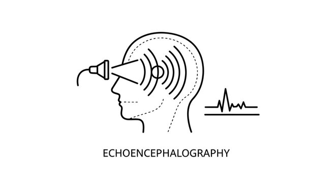 Linear medical illustration of echoencephalography showing a human head scan with ultrasonic waves and brainwave monitors, representing neurology, diagnostics, and healthcare.