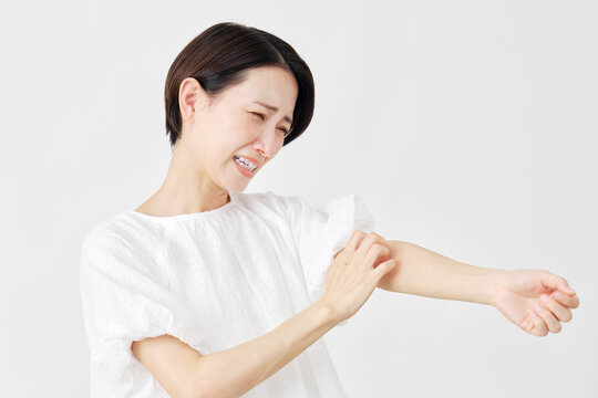 ミドルエイジ女性　蕁麻疹　白背景