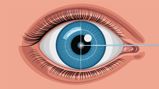 Detailed illustration of a blue human eye undergoing a laser surgery procedure or an advanced retinal scanning process.