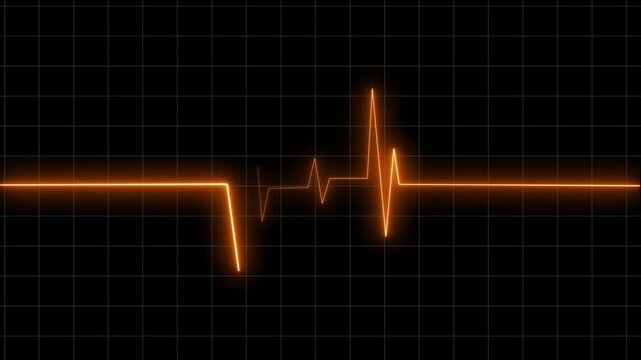 Heartbeat Monitor Animated Video, Heartbeat Medical Cardiogram Animation