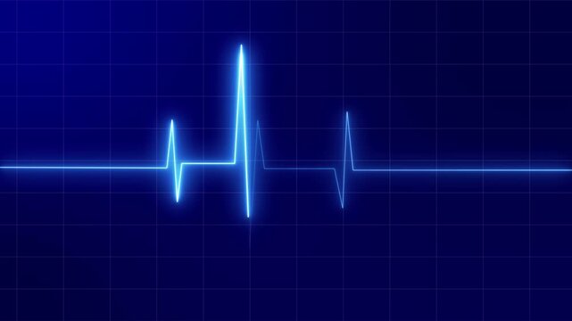 Heartbeat Monitor Animated Video, Heartbeat Medical Cardiogram Animation