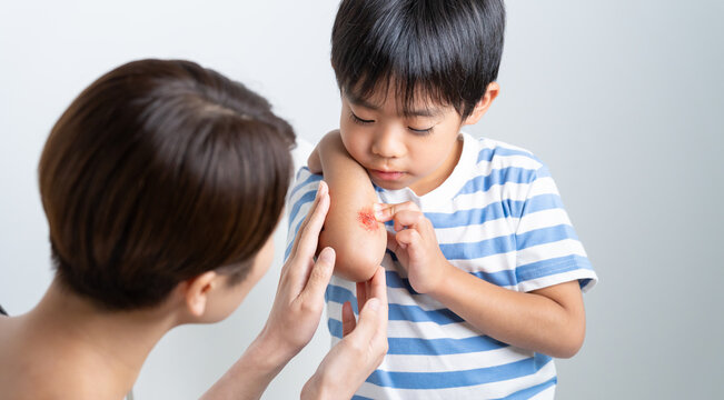 腕に擦り傷の怪我をする子供と手当てする母親・特殊メイク