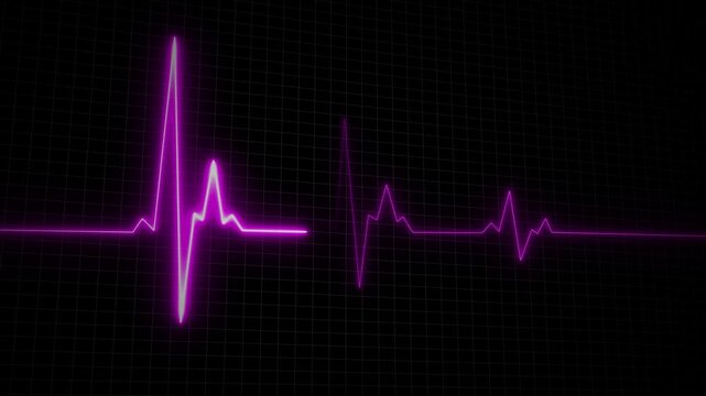 Neon purple ekg heartbeat monitor pulse line on digital grid background, medical